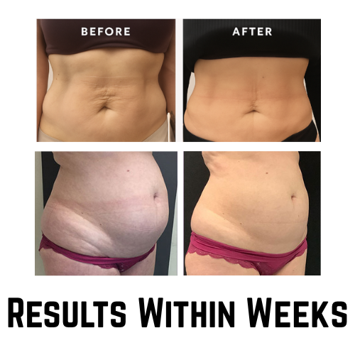 Clareive Belly Firming Cream