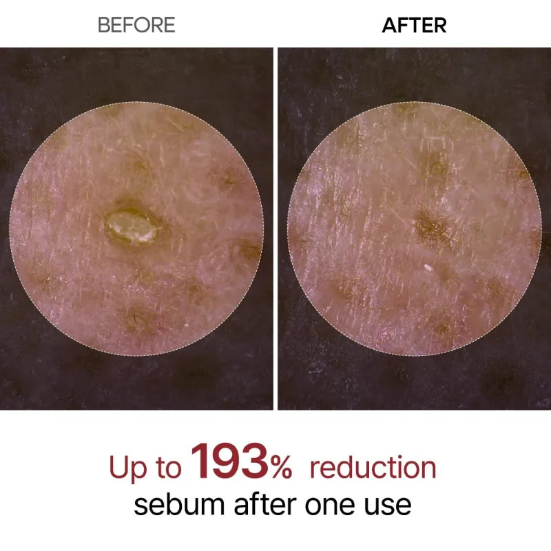 80ML Original Niacinamide Face Serum-Brightening Pore Minimizing White Rice Black Rice Amino Acid Rice Dark Spots Oil Control